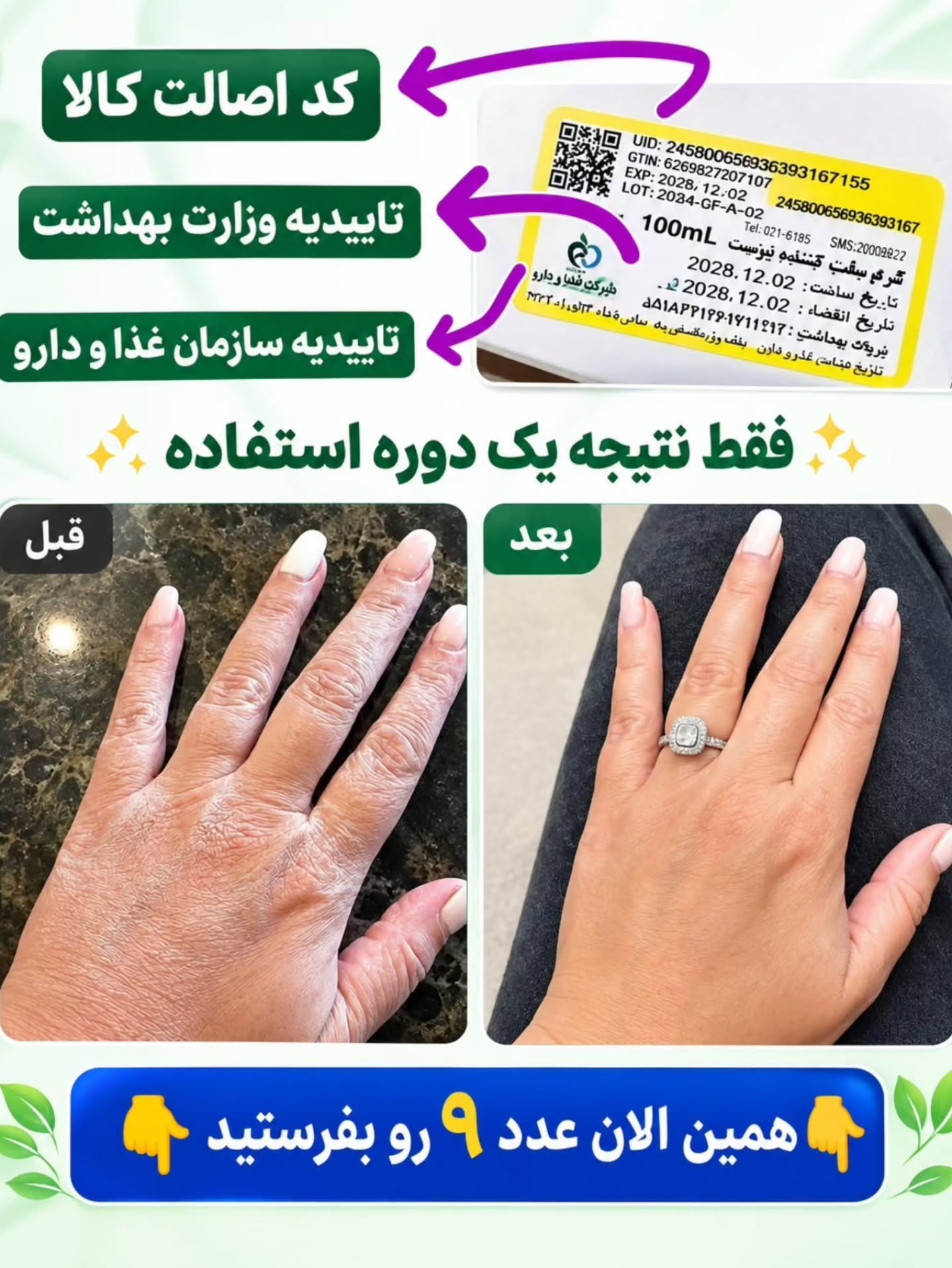 کرم الاستین
