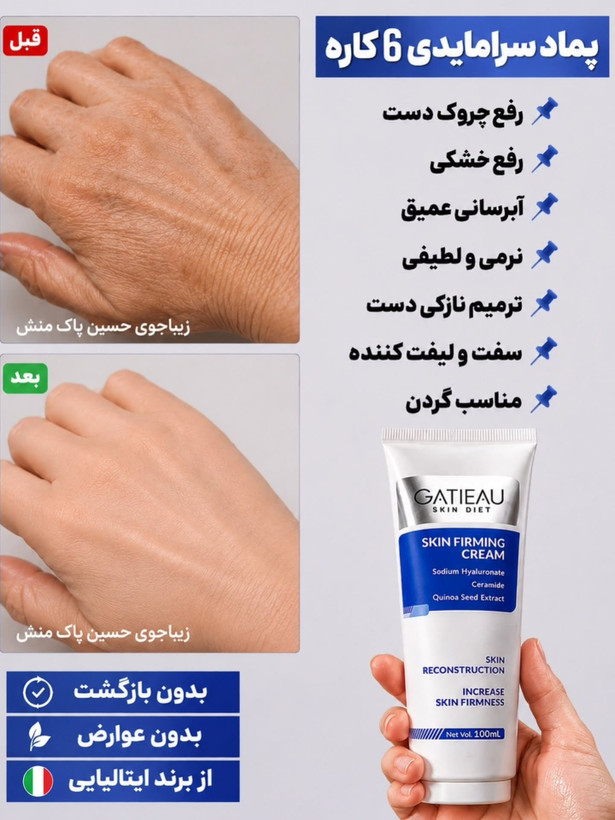 کرم الاستین