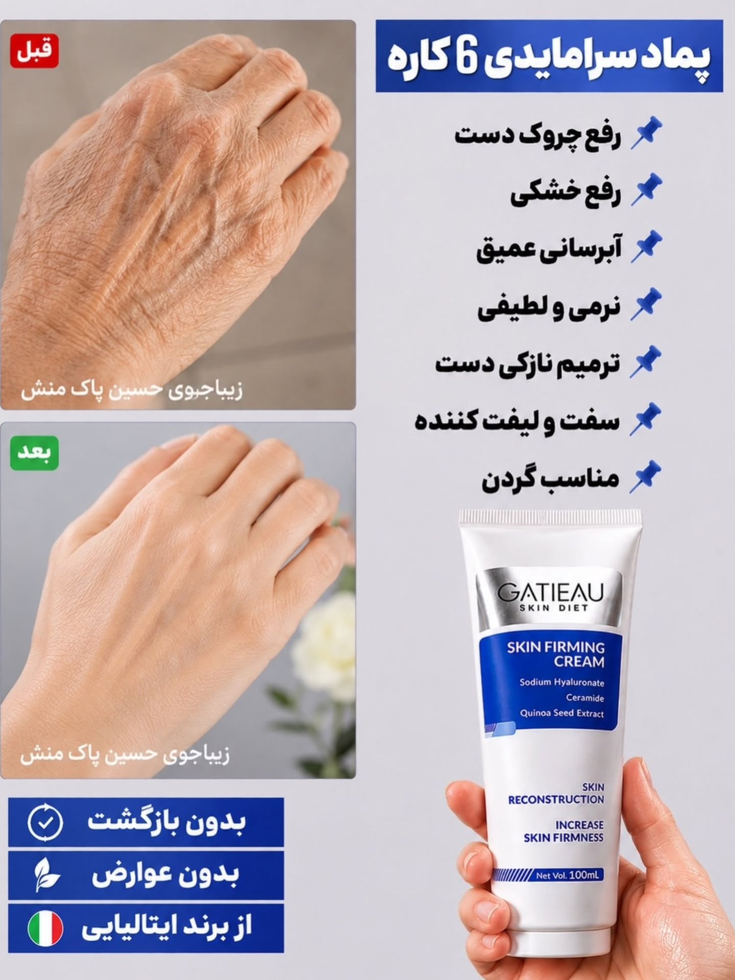 کرم الاستین