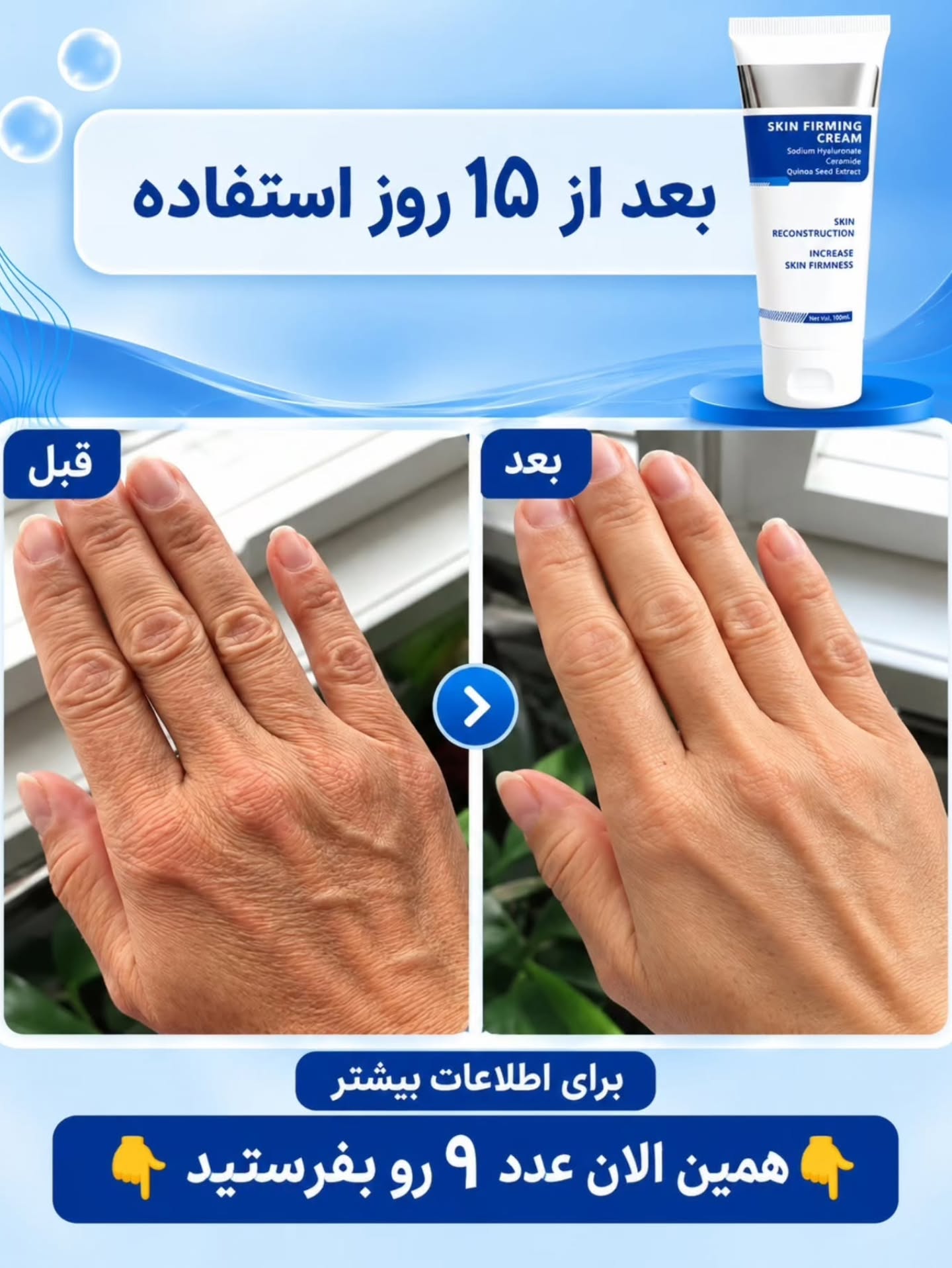 کرم الاستین