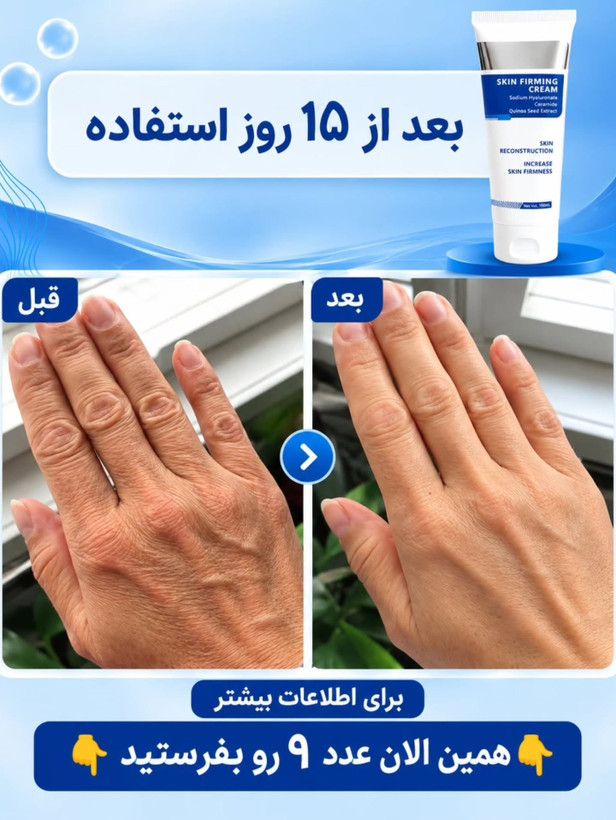 کرم الاستین
