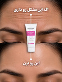 کرم بوتاکس ۵ کاره